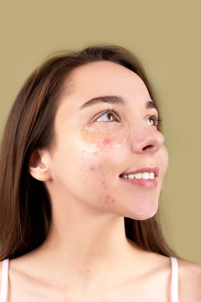 What is Best Skincare Routine for Oily Skin?